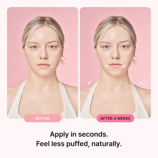 RETURNITY Fülre Ragasztható Akupresszúrás Kezelés Tapasz 30db